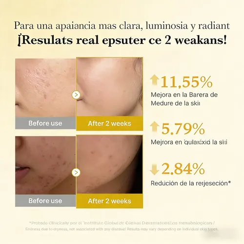 Suero Iluminador Antimanchas Kójico Curcuma Niacinamida 30 M
