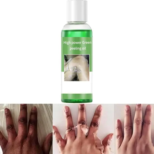 Aceite Exfoliante Genérico Extra Fuerte Para Piel Oscura 110