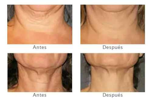 Crema Neostrata Skin Active Reafirmante Cuello Escote 80 Ml