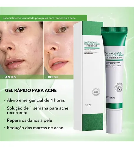 Crema De Ácido Salicílico Aa X Z Para Remoción De Poros Acné