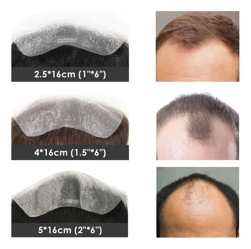 Sj Nuevo 4 X16cm Sistema Capilar Frontal De Cabello !/*