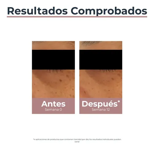 Contorno De Ojos Anti-ojeras Eucerin Todo Tipo De Piel Día/noche 15 ML