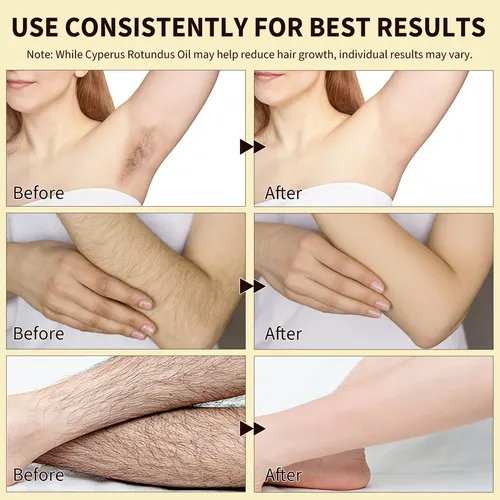 Aceite Natural De Ciprés Para Reducir El Vello Facial Y Corp