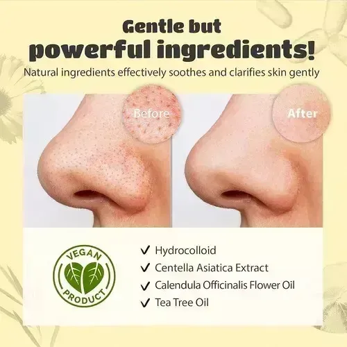 Mascarilla Tira Facial X50 Unidad Limpieza Puntos Negros