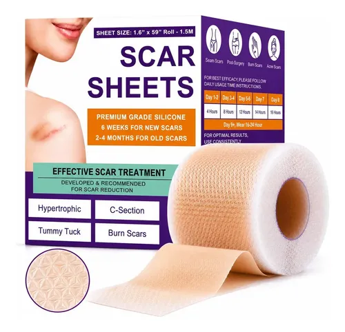 Rollo de Parche de Silicona para Eliminar Cicatrices y Queloides 1.5Mts