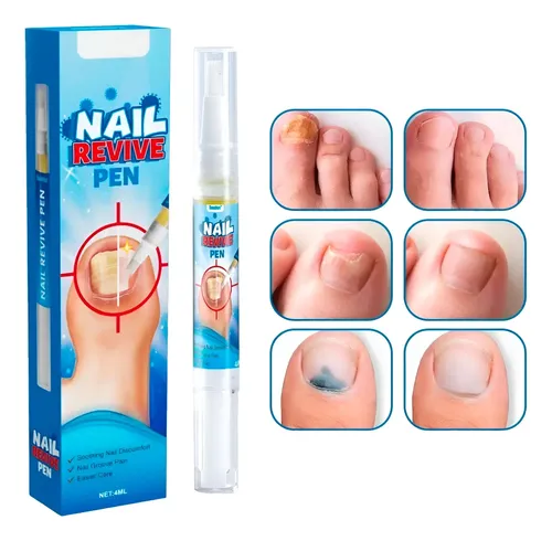 Tratamiento Suero Uñas Amarillas Antihongos Manos Pies