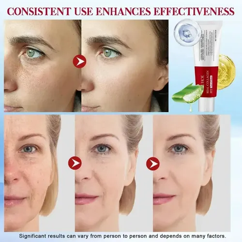 Mtt. Mascarilla Exfoliante De Colágeno Coreana Top1.top1*