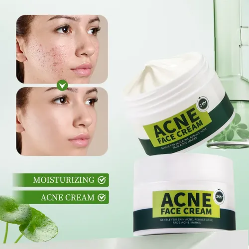 Crema Antiacné Para Reducir Las Marcas Del Acné