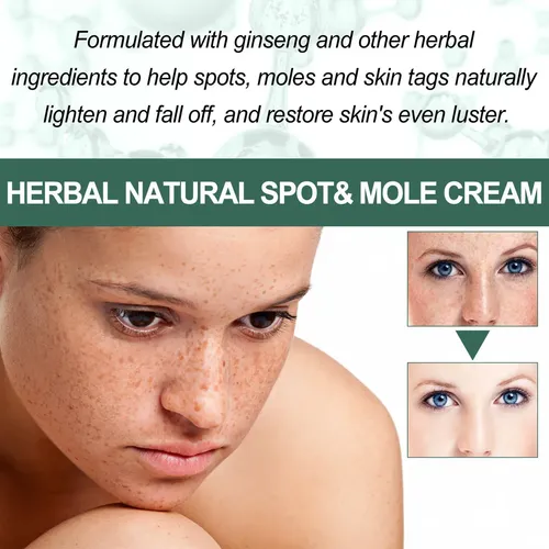 Eg Crema Antipecas Natural For Aclarar Las Manchas